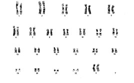 cariotipo de mujer