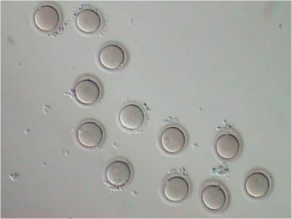 Hablemos de la donacion de ovulos