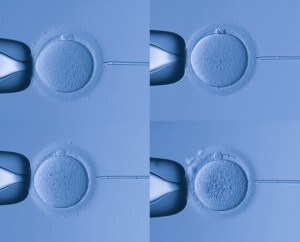 La inseminacion artificial